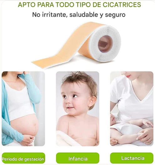 Desaparece cicatrices, gana confianza