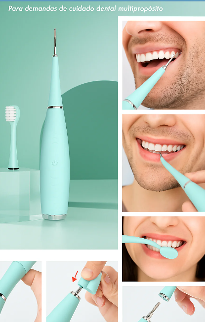 SmilePro™ – Tu limpieza dental segura y económica, sin salir de casa